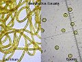 Hemitrichia clavata-amf2017-micro